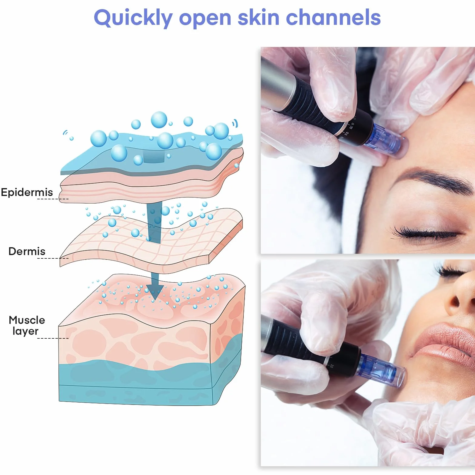 Aghi microneedling 36 punte, Dermapen Microneedling cartucce di ricambio per Derma Pen A6/A10, Cartucce Needling viso con fessura a baionetta (20 pezzi)