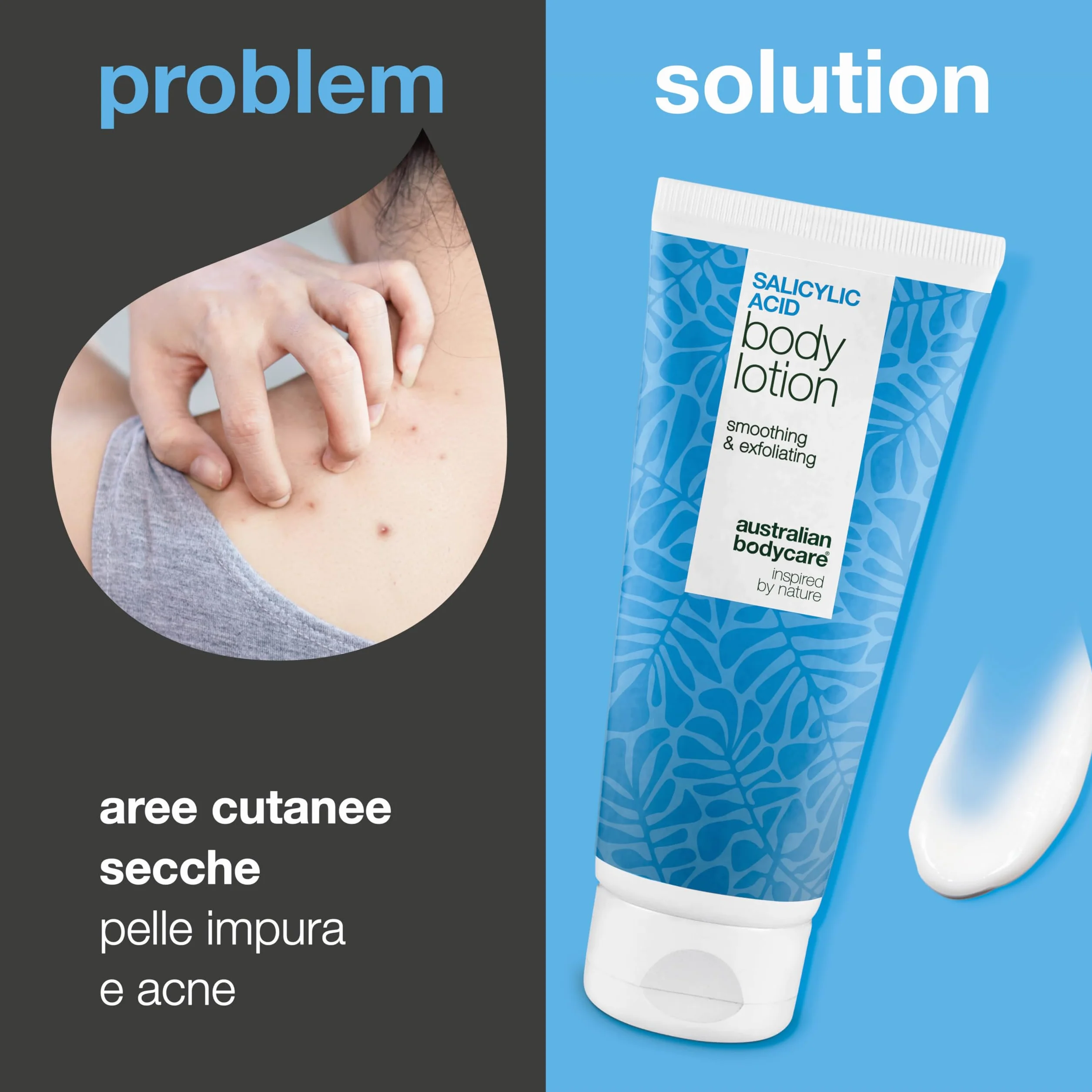 Lozione corpo con acido salicilico (200 ml) – per imperfezioni, pelle secca e grassa. Con BHA, niacinamide e acido ialuronico per esfoliare e idratare