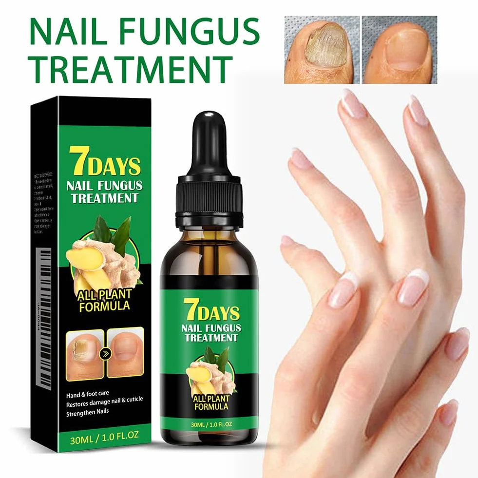 Siero per Unghie allo Zenzero da 30 ml, Siero per Unghie Rinforzante e Riparatore, Olio per Unghie allo Zenzero per Rafforzare le Unghie