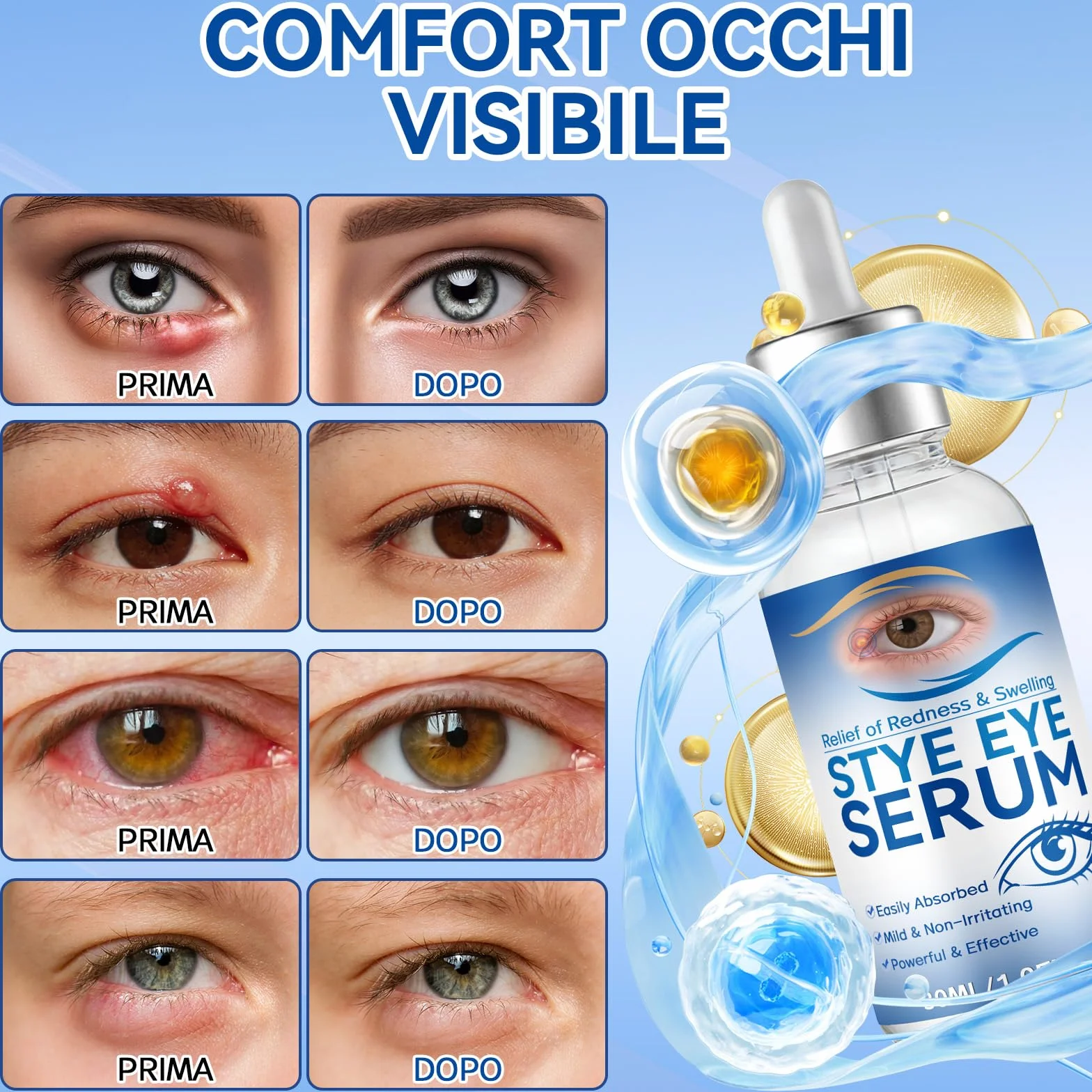 Siero Oculare per Orzaioli, Siero Naturale per Occhi, Adatto a Orzaioli, Blefarite, Calazi e Secchezza Oculare, Pulizia quotidiana occhi, Allevia la Secchezza, Dona Una Pelle Più Sana