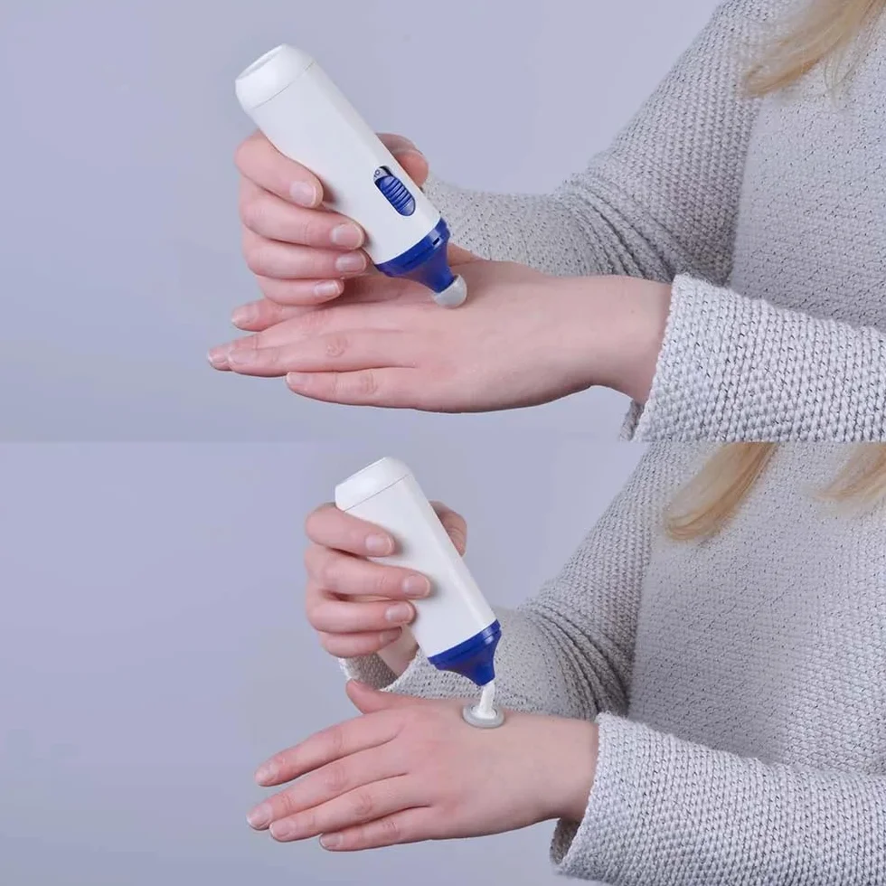 ScarGone Massaggiatore per minimizzare le cicatrici, trattamento efficace per viso e corpo, mira a cheloidi, acne, ustioni, scure e cicatrici chirurgiche, riduce la comparsa di ferite nuove e vecchie