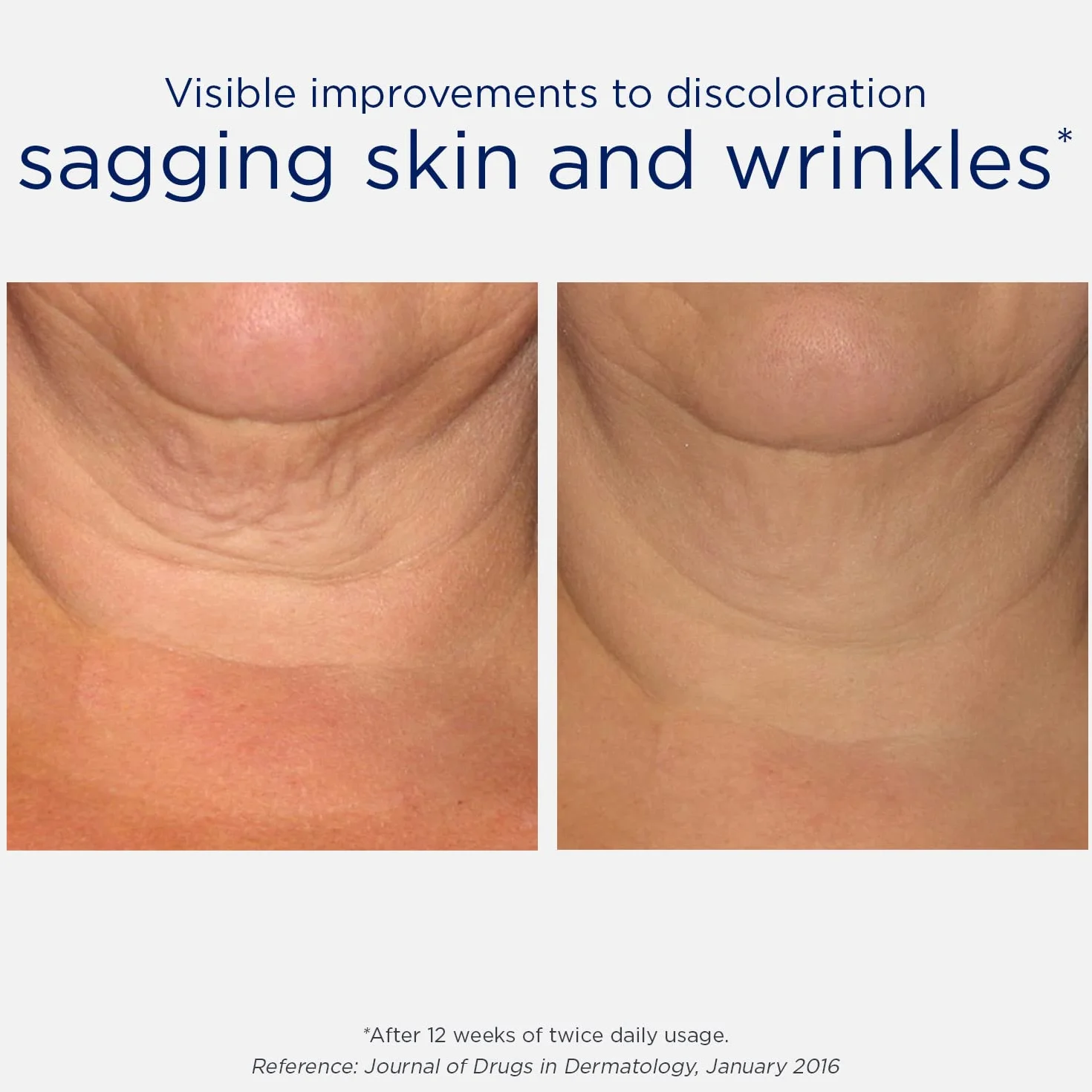 NeoStrata Skin Active Triple Firming Neck Cream, 80 g