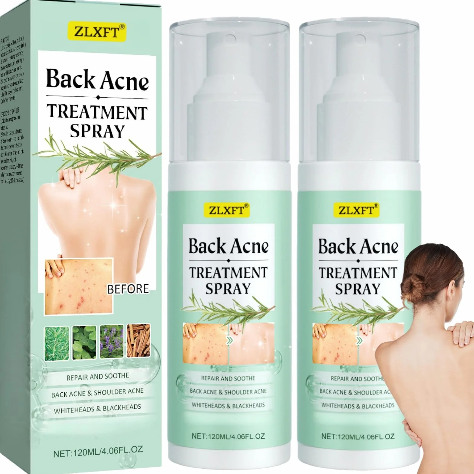 Torna Soluzione Brufolo,2pcs Spray per Brufoli Corpo,Spray per la Rimozione dei Brufoli Sulla Schiena,Post Acne Trattamento Sprays,Acnes Sprays Back And Chest,Body Acnes Sprayss