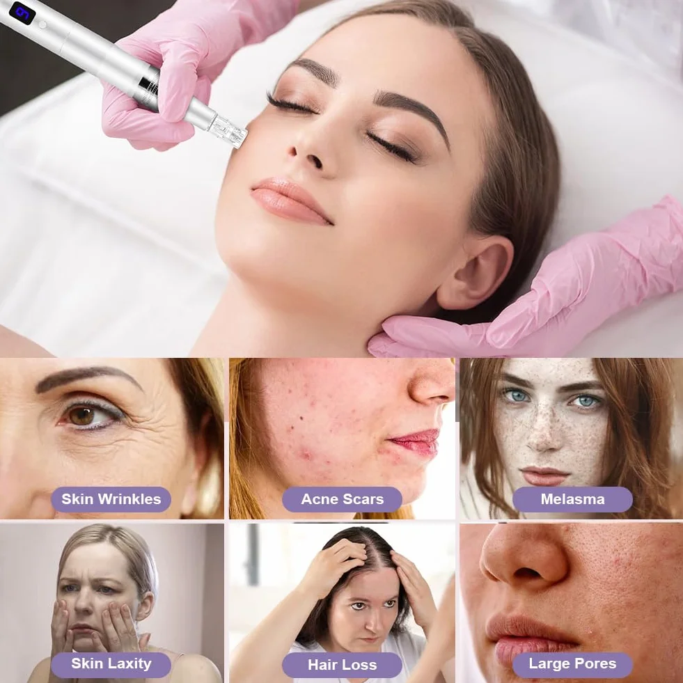 Vicloon Elettrico Dermapen Microneedling Professionale, Derma Penna con Schermo LCD e 6 Livelli incl. 12 pezzi Cartucce, Regolabile 0-2,5 mm (Argento)