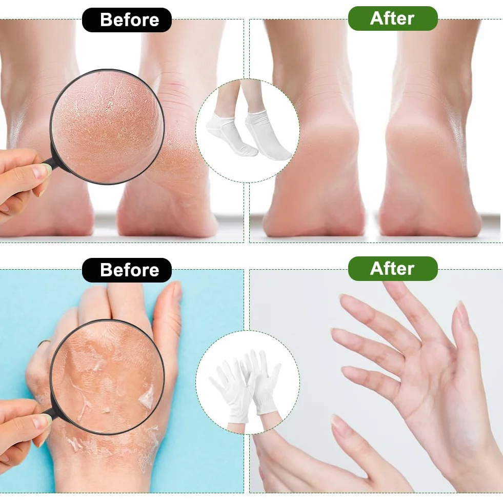 Guanti in Cotone Bianchi e Ccalzini Idratanti per Piedi Set, Riutilizzabili 2 paia Guanti in Cotone Bianco e 2 paia Calze Idratanti in Cotone per le Donne Eczema Mani Secche Cura Della Pelle e del Spa