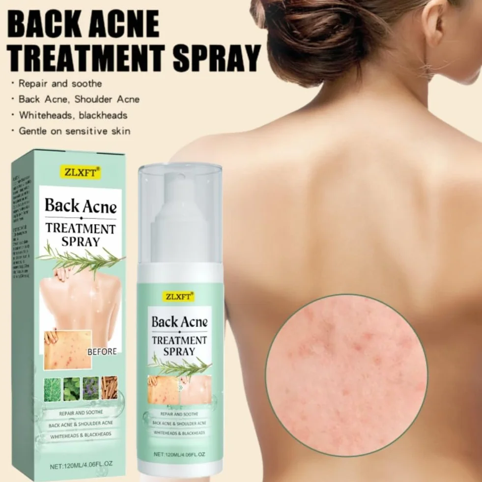 Torna Soluzione Brufolo,2pcs Spray per Brufoli Corpo,Spray per la Rimozione dei Brufoli Sulla Schiena,Post Acne Trattamento Sprays,Acnes Sprays Back And Chest,Body Acnes Sprayss