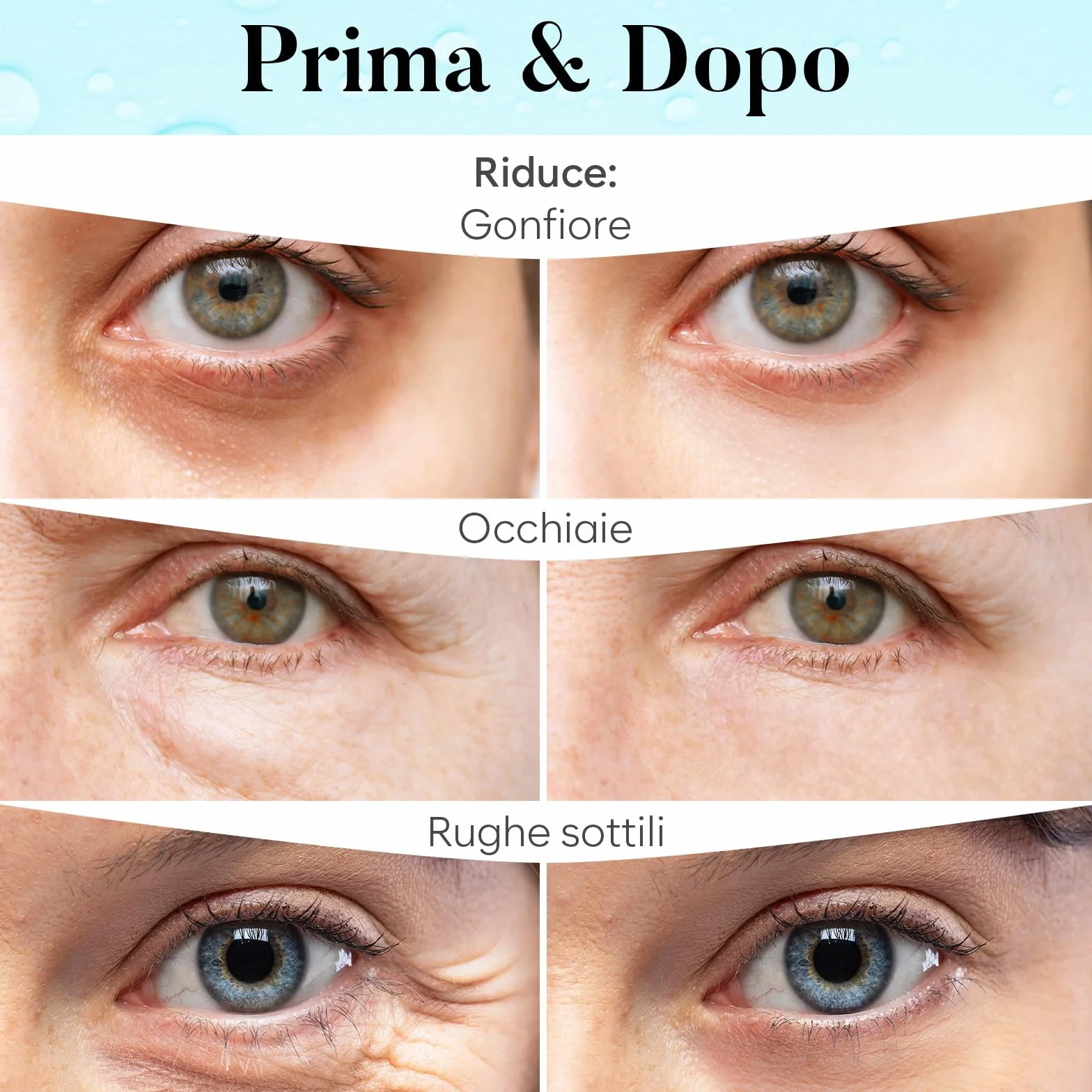 AURAE Patch Occhi, Maschera Occhi con Retinolo e Collagene, Patch Occhiaie e Borse, Maschera Occhiaie, Eye Mask per Schiarente e l'idratazione (30 Paia)