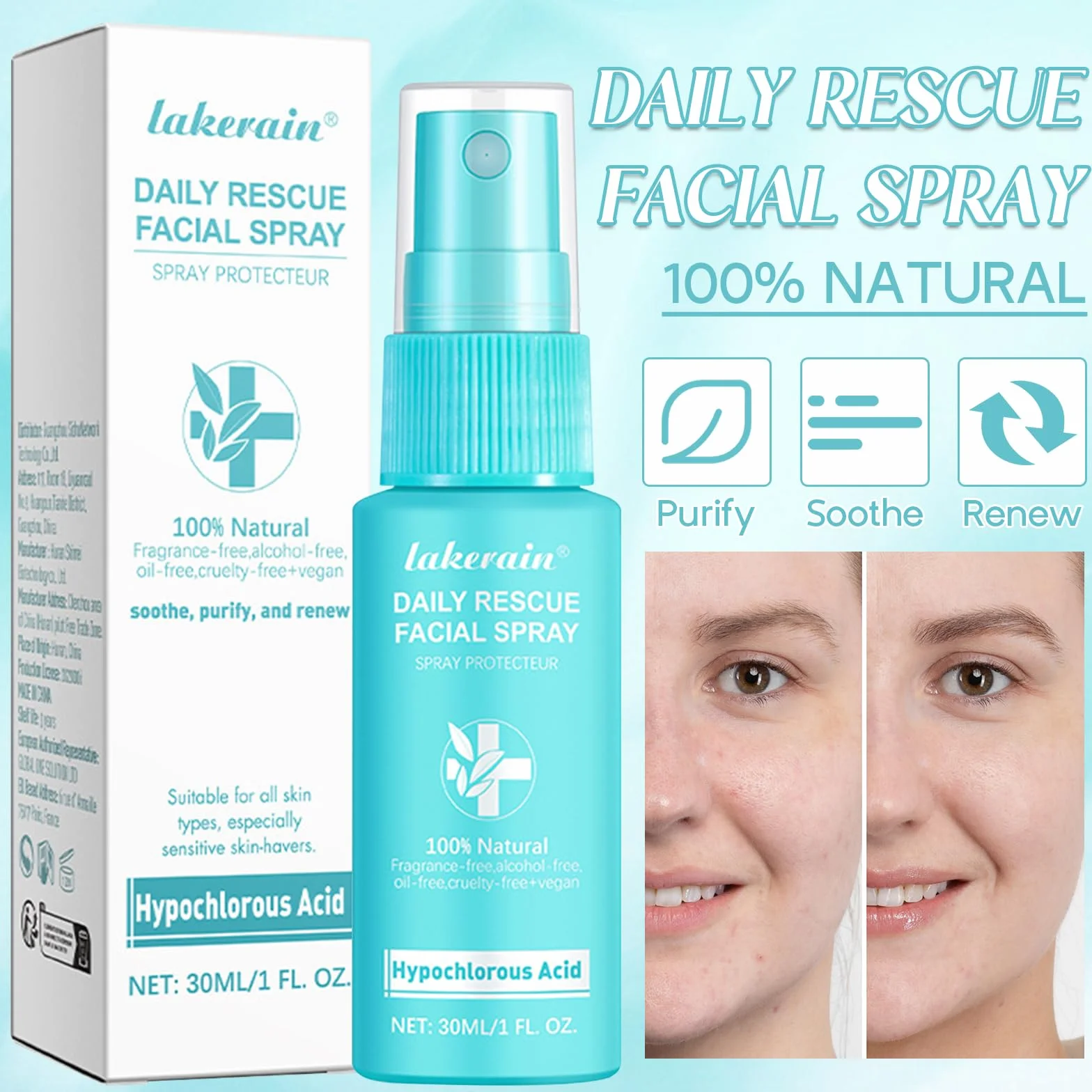 3 Piezas Acido ipocloroso Spray,Spray per viso, sicuro sulla pelle, adatto per cuoio capelluto secco e post-operatorio. Idrata e protegge la tua pelle