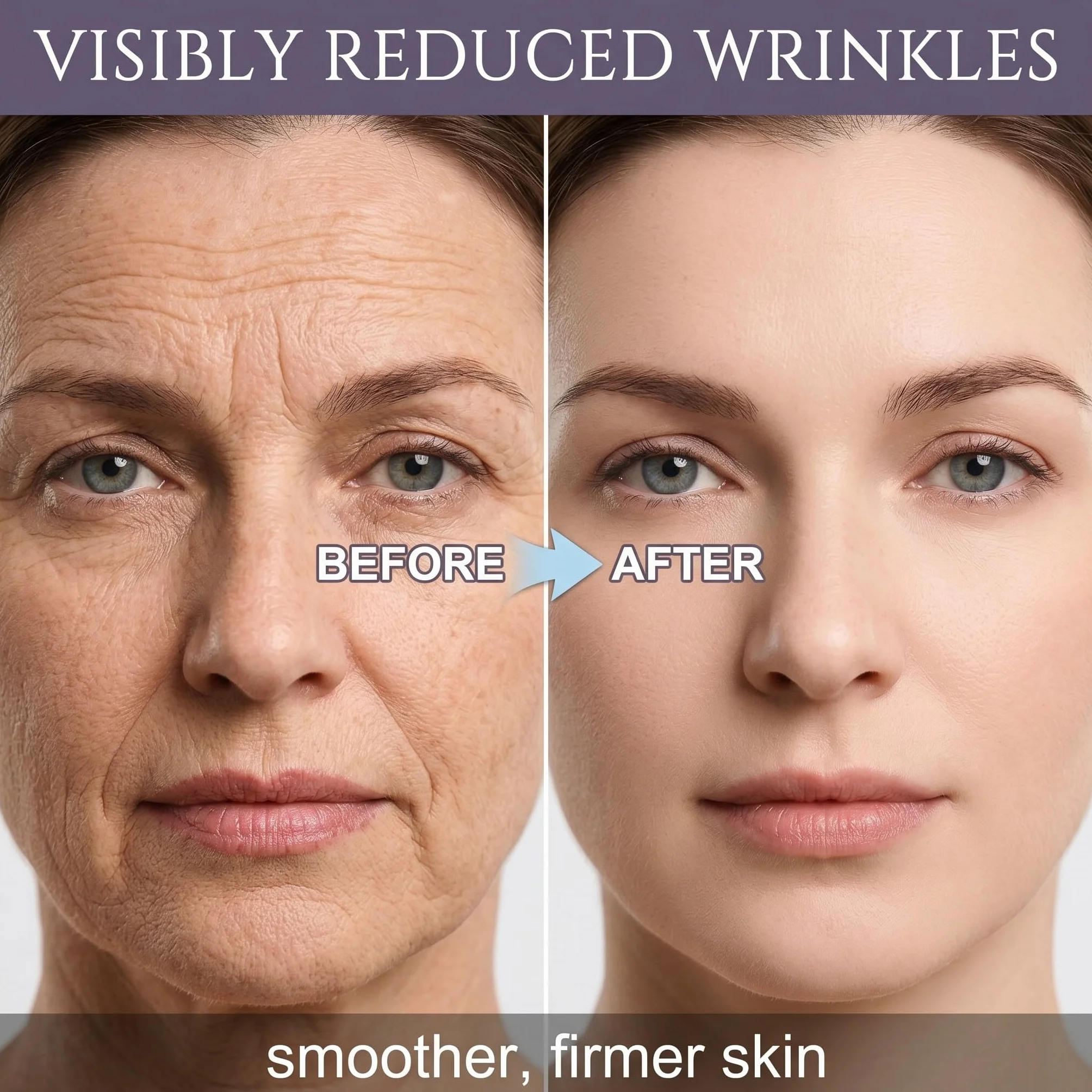 162 Cerotti Antirughe Viso e Fronte, Patch Antirughe Trasparenti per Donna, Trattamento Notturno per Linee Sottili, Rughe Nasolabiali e Contorno Occhi, Effetto Lifting Naturale