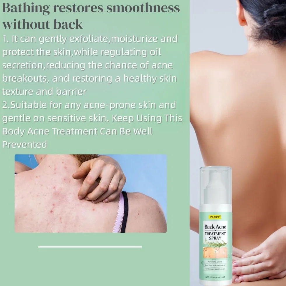 Torna Soluzione Brufolo,2pcs Spray per Brufoli Corpo,Spray per la Rimozione dei Brufoli Sulla Schiena,Post Acne Trattamento Sprays,Acnes Sprays Back And Chest,Body Acnes Sprayss