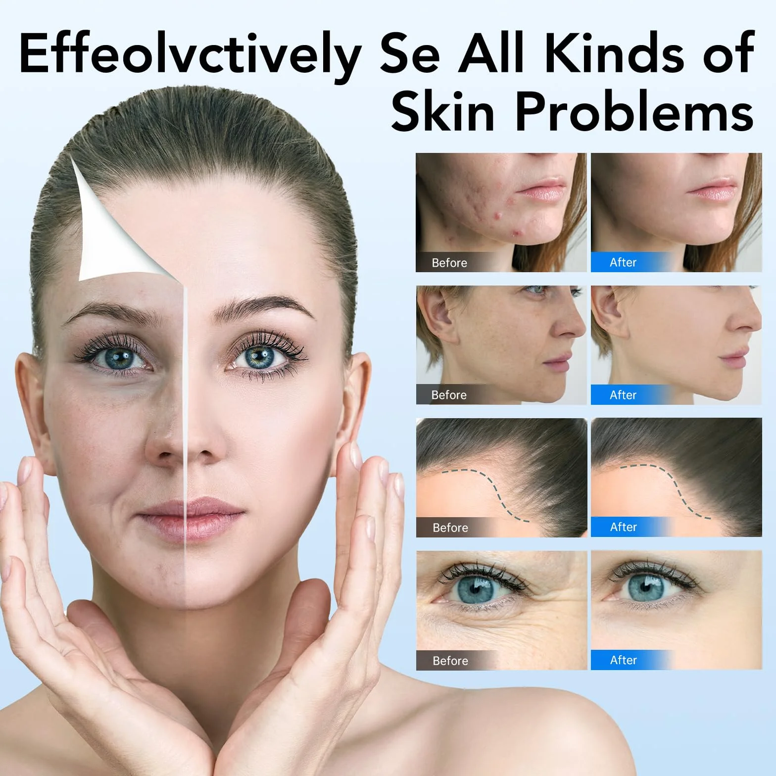 Dr.Pen - Penna per microneedling A6 per viso e corpo, Derma Pen per siero cicatrici a 5 velocità di profondità, regolabile, con 2 batterie di riserva e 10 cartucce, con cavo a 36 pin e spina UK