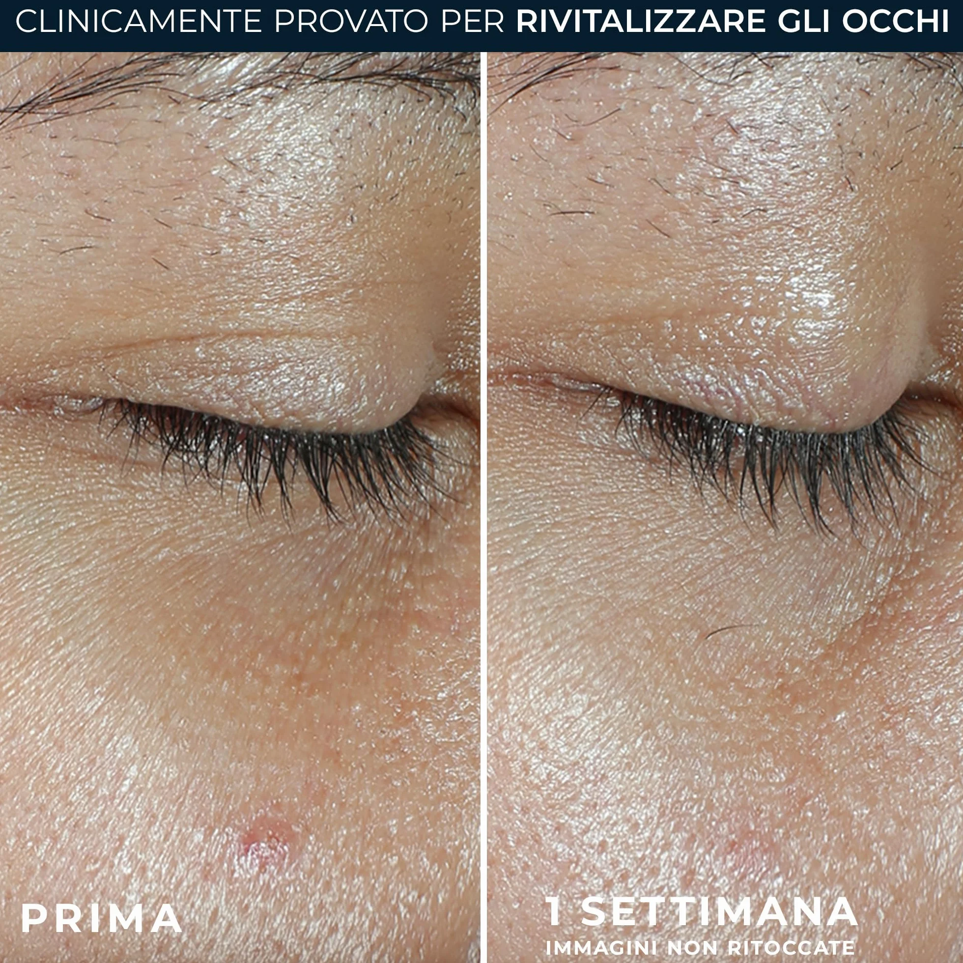 RoC - Multi Correxion Revive + Glow Balsamo Occhi - Formula Alla Vitamina C E Ai Peptidi - Riduzione Delle Cricche Scure E Delle Borse - Applicazione Senza Contatto - Ipoallergenico - 4g