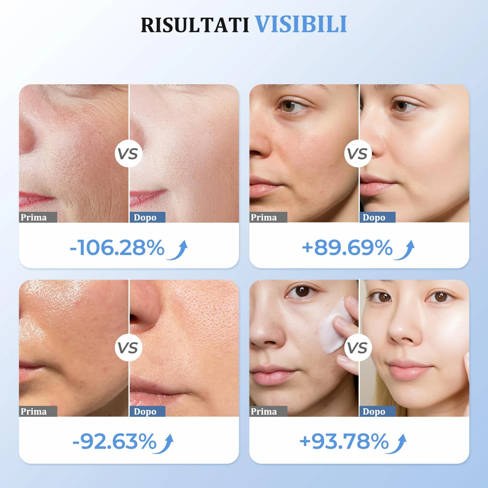 Radiofrequenza Viso Professionale, Microcorrente Massaggiatore Viso, Dispositivo Elettrico di Bellezza Antirughe, Antietà, Anti-Acne, Lifting e Rassodante per Viso e Collo