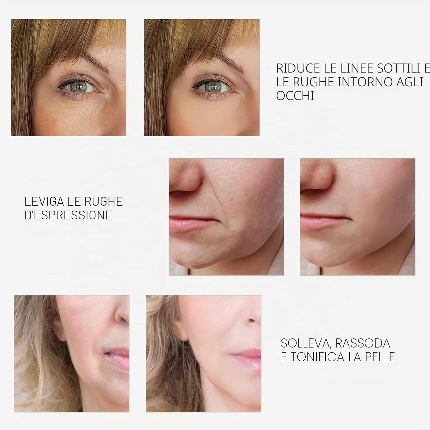 RF Radiofrequenza viso e corpo macchina rassodante – Professionale Home RF Lifting Skin Care Anti Aging Device – Effetti salone / più sicuro (bianco)