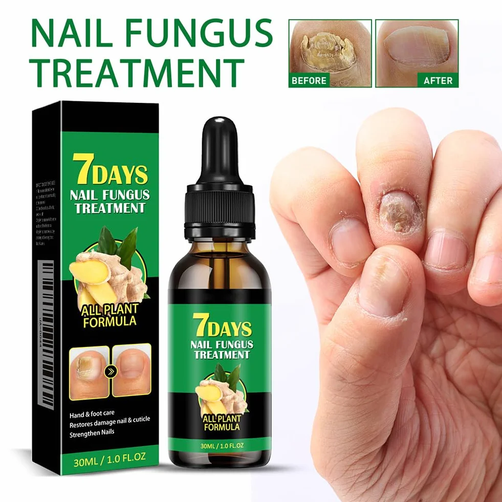 Siero per Unghie allo Zenzero da 30 ml, Siero per Unghie Rinforzante e Riparatore, Olio per Unghie allo Zenzero per Rafforzare le Unghie