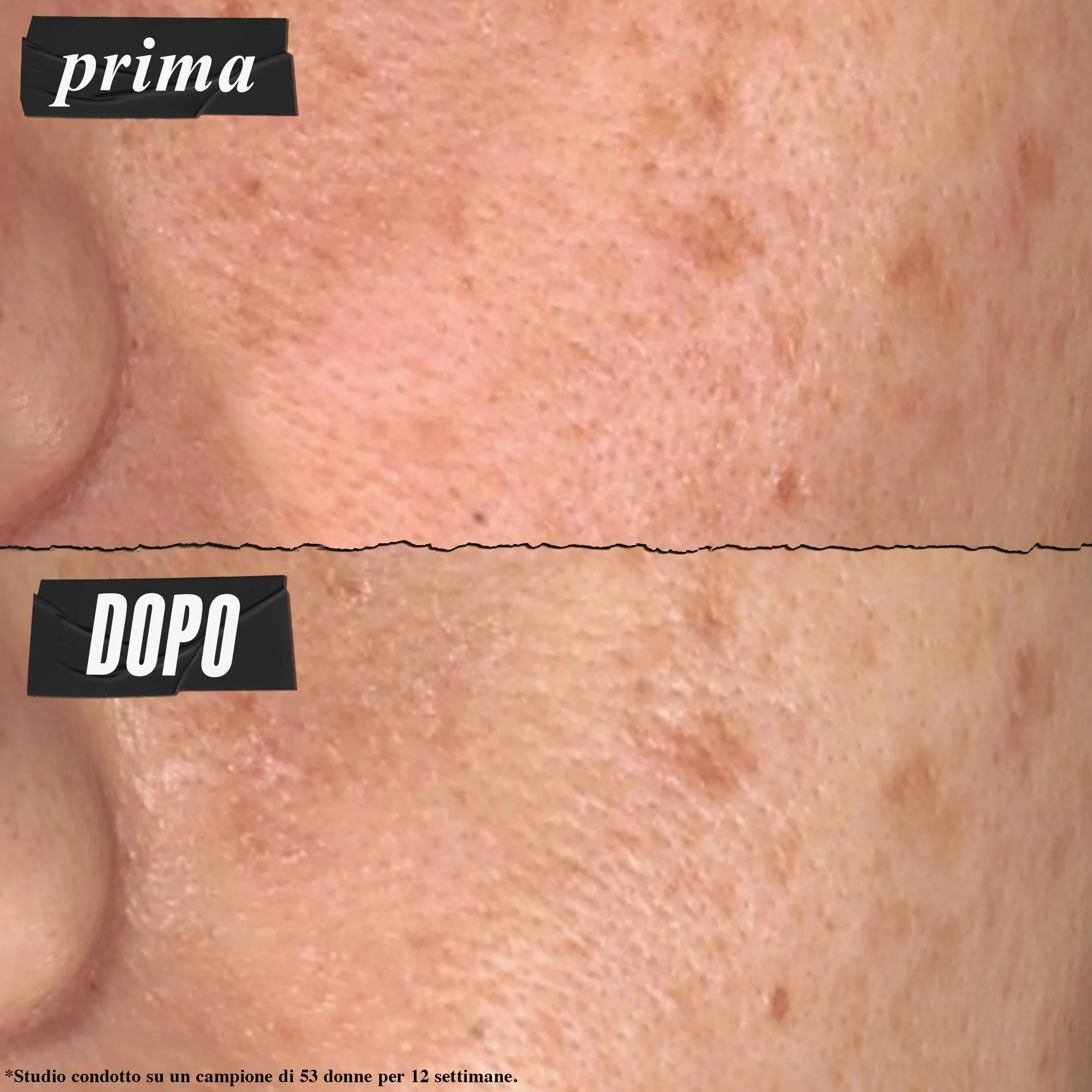 KIEHL'S Super Multi-Corrective Cream, Crema Idratante Anti Età, Per Tutti i Tipi di Pelle, Rassoda, Leviga, Illumina, Pelle Visibilmente Più Giovane, Con Adenosina e Proxylane