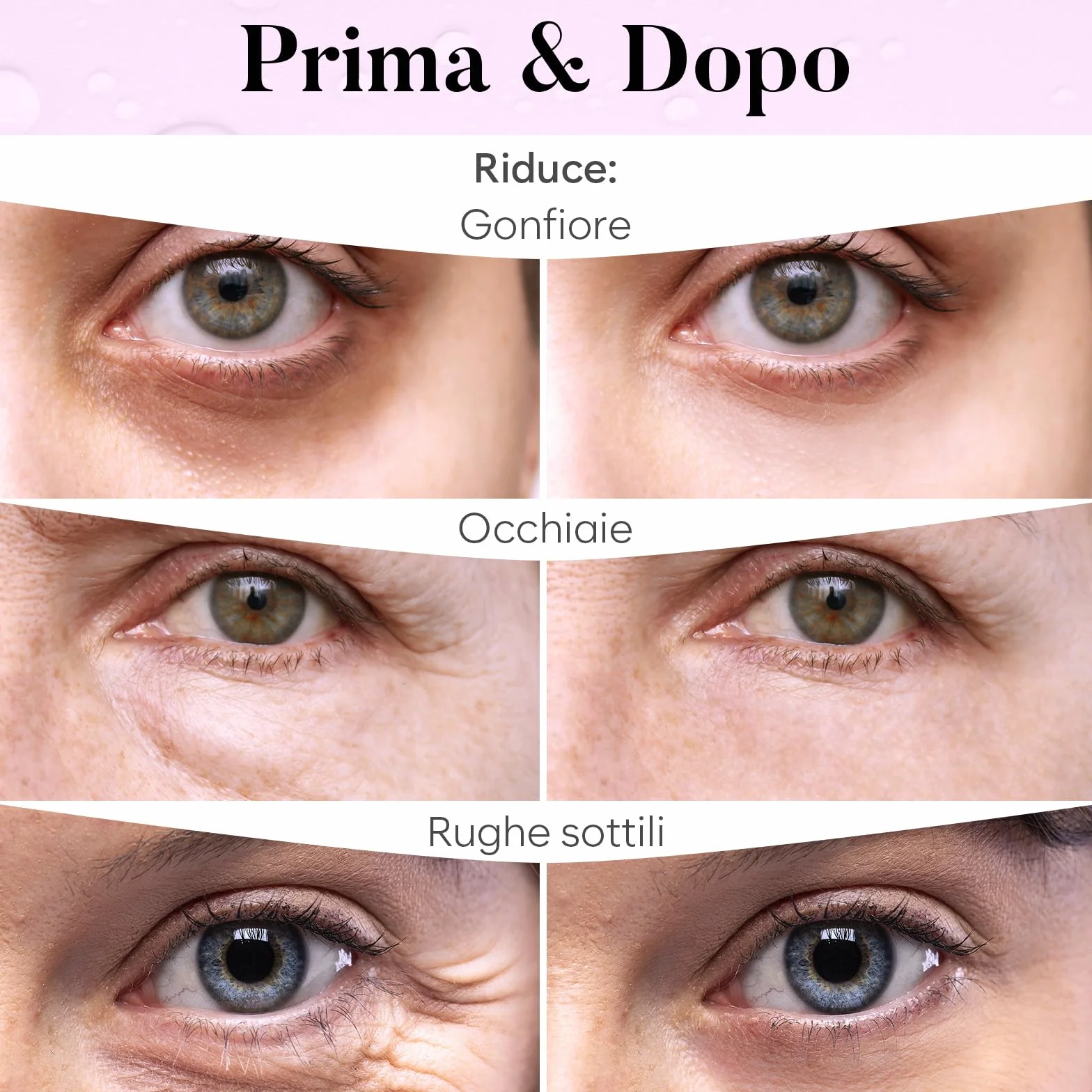 Patch Occhi, Maschera Occhi con PDRN, Caffeina e Collagene, Patch Occhiaie e Borse, Maschera Occhiaie, Eye Mask per Schiarente e l'idratazione (30 Paia)