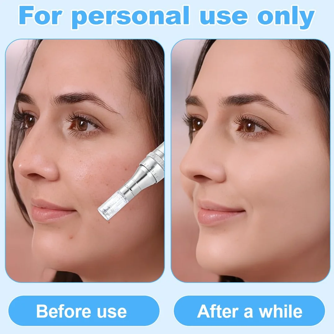 10 Pezzi 12 pin micro nano aghi per modello, aghi di ricambio per microneedling, universale compatibilità con Microneedling, microneedling viso, per il ripristino della pelle
