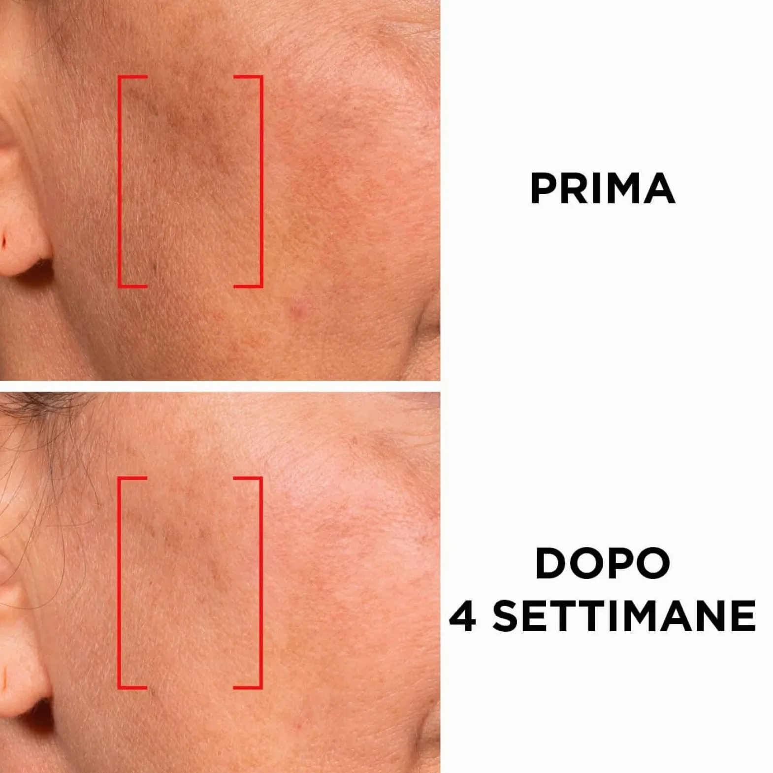 L'Oréal Paris Revitalift Laser Crema Giorno + Notte + Trattamento, Set da 3 | Kit Viso Anti-Età e Antirughe, Ridensificante Rassodante Illuminante