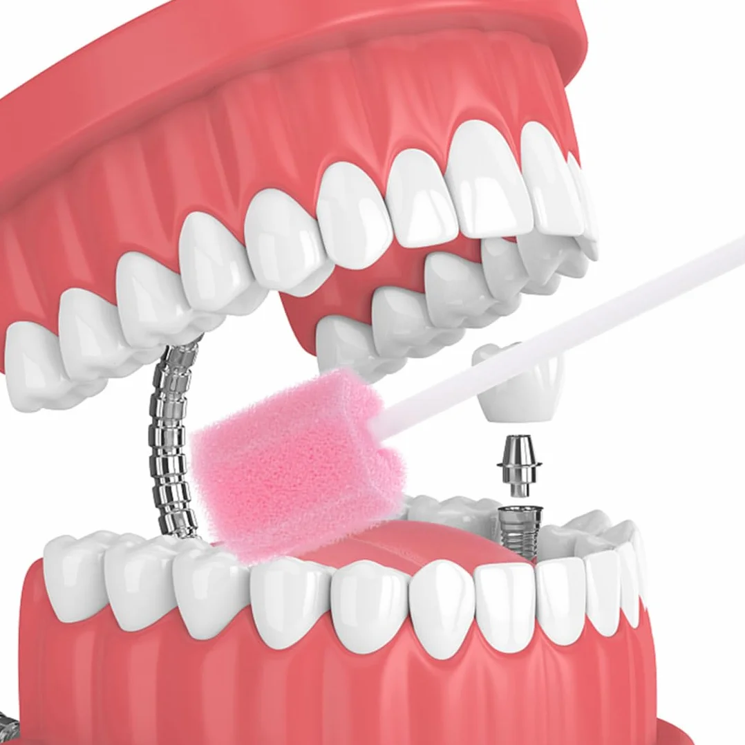 100 tamponi in spugna per l'igiene orale, usa e getta, con bastone, rosa, comodi tamponi dentali per la pulizia dei denti