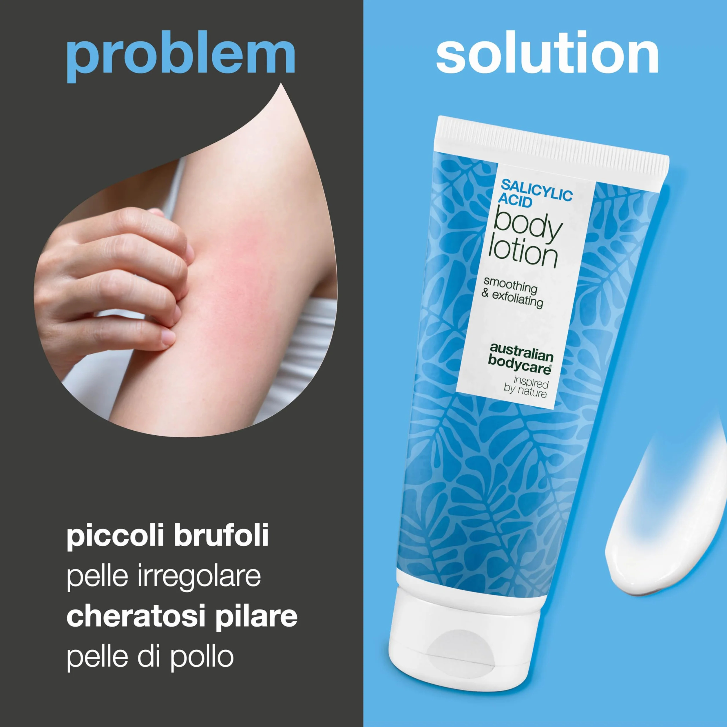 Lozione corpo per Keratosis Pilaris – elimina pelle a buccia d’arancia e ruvidità – con acido salicilico, niacinamide e zinco PCA