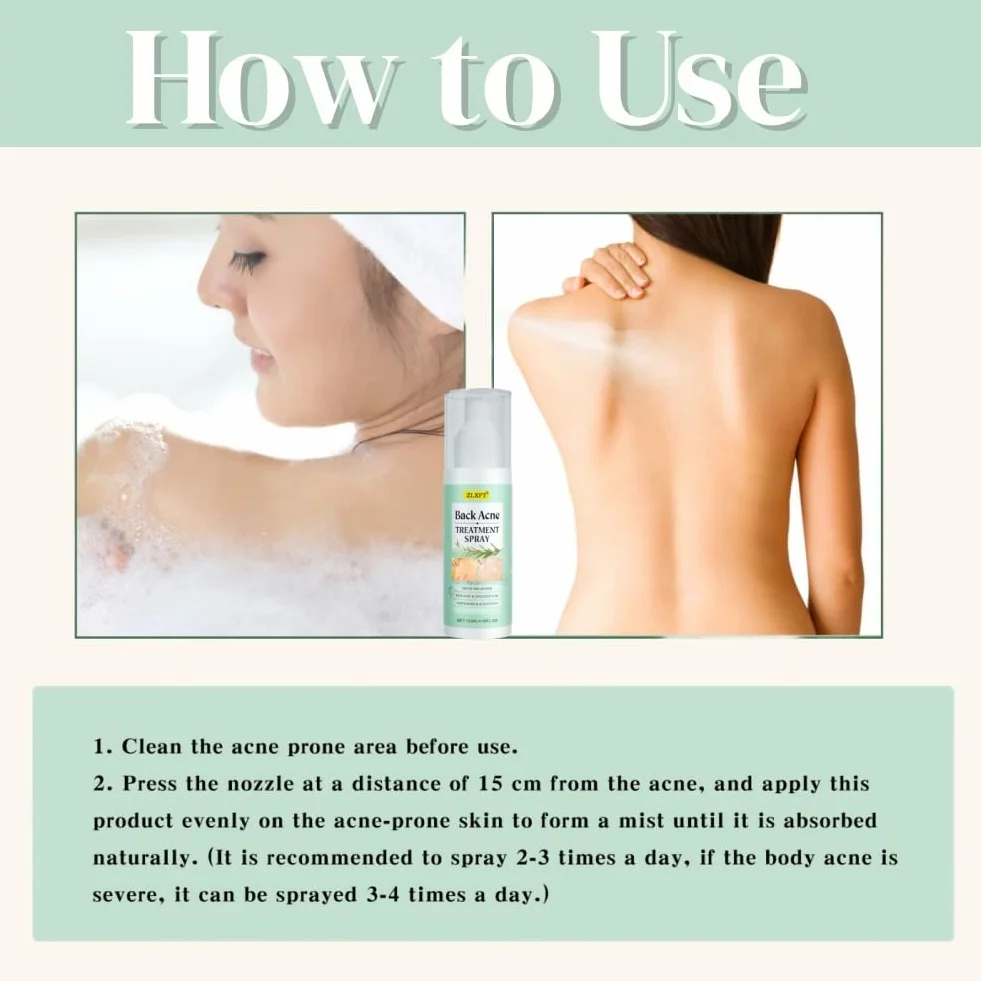 Torna Soluzione Brufolo,2pcs Spray per Brufoli Corpo,Spray per la Rimozione dei Brufoli Sulla Schiena,Post Acne Trattamento Sprays,Acnes Sprays Back And Chest,Body Acnes Sprayss