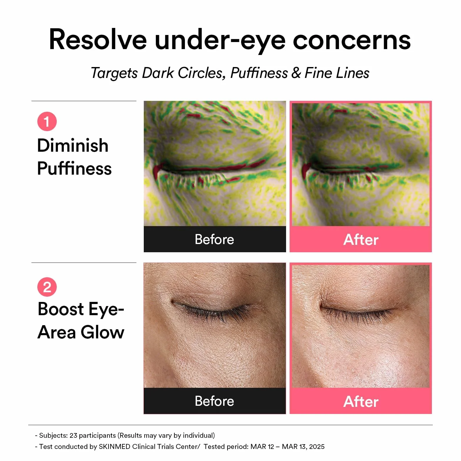 Abib Cerotti Per Gli Occhi Pdrn Retinal Eye Patch Glow Jelly Coreani Per Occhi Gonfi E Occhiaie, Antirughe, Collagene, Caffeina, Niacinamide 60 Cerotti,