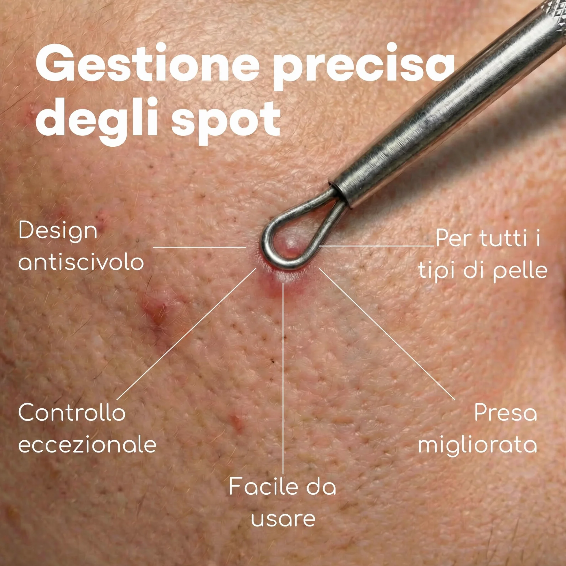 Medi Grade Kit Schiaccia Brufoli e Estrattore Punti Neri Medi Grade, Set di 7 Strumenti Togli Punti Neri
