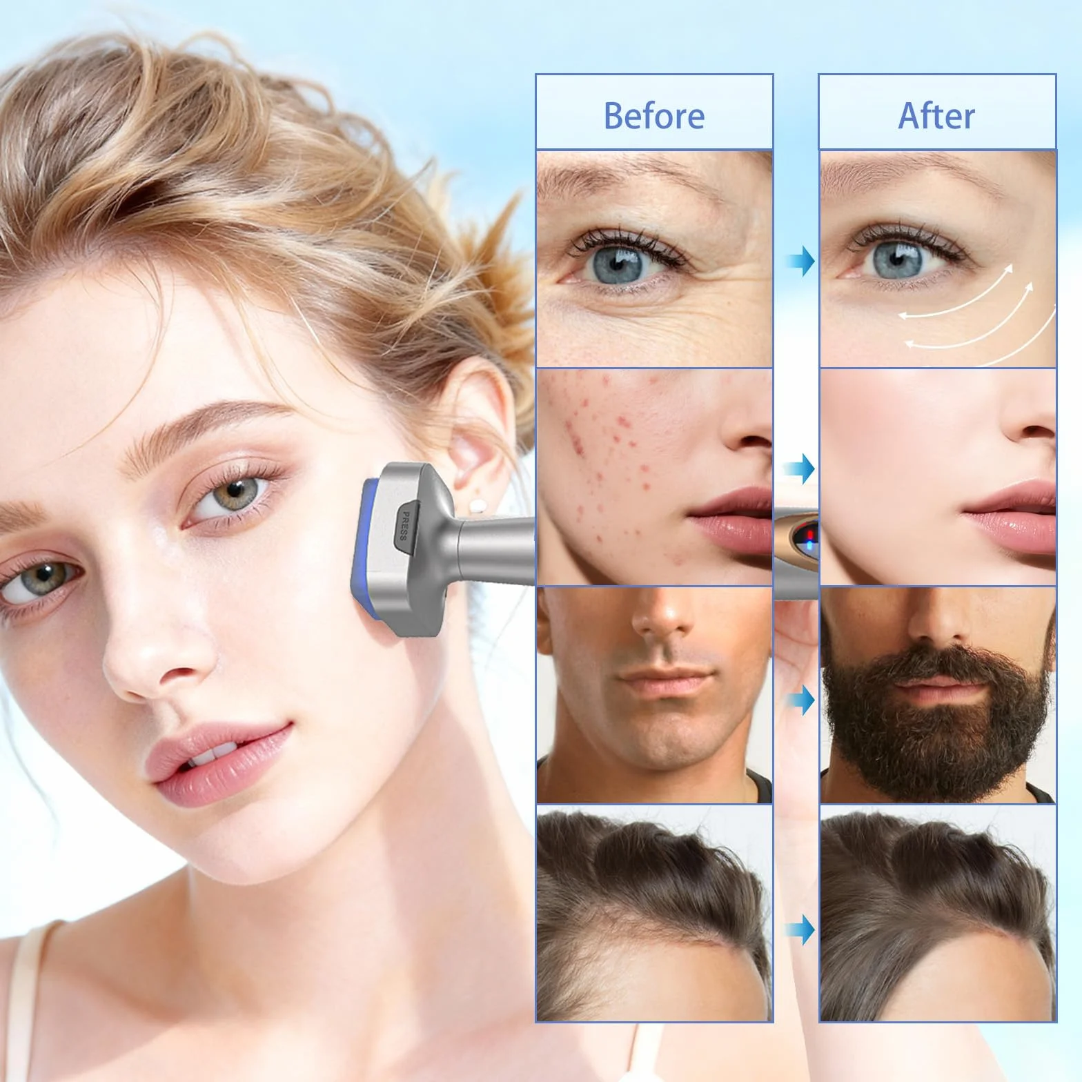 Microneedling Stamp Bio 6 – Derma Stamp Professionale 4 in 1 con Microneedling, EMS, Terapia Luce Rossa/Blu, Massaggio Vibrante– Ringiovanimento Viso, Anti-Età, Crescita Capelli
