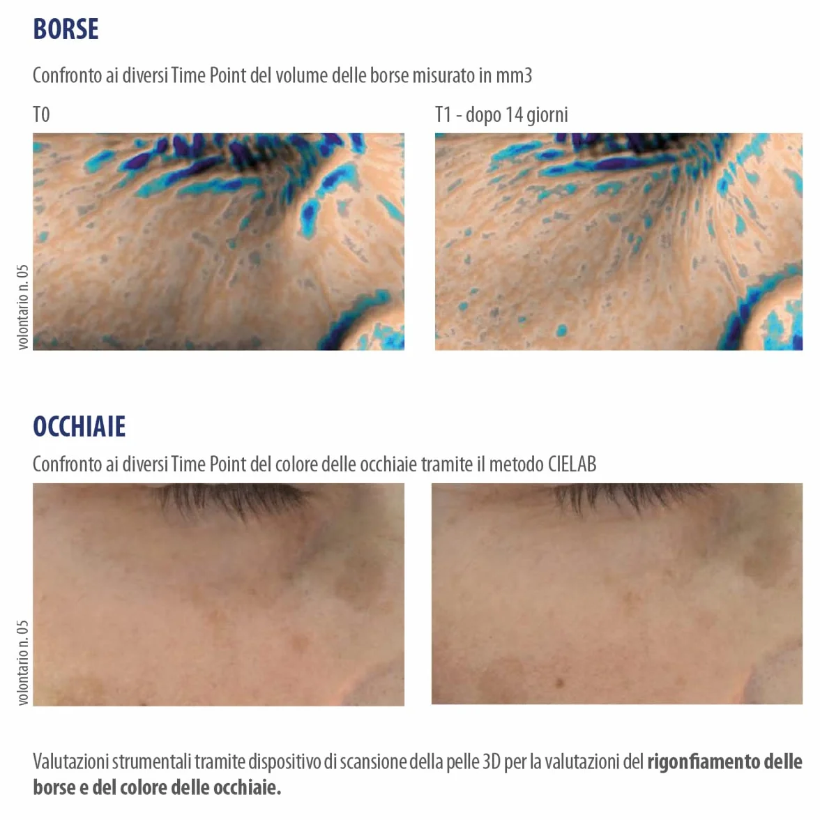 Helan, IREOS - Contorno Occhi Occhiaie Effetto Lifting, Siero Contorno Occhi e Borse Sgonfiante in Formula Gel con Fresco Roll On in Acciaio - Prodotto Skincare Illuminante Antiage con Caffeina, 10 ml