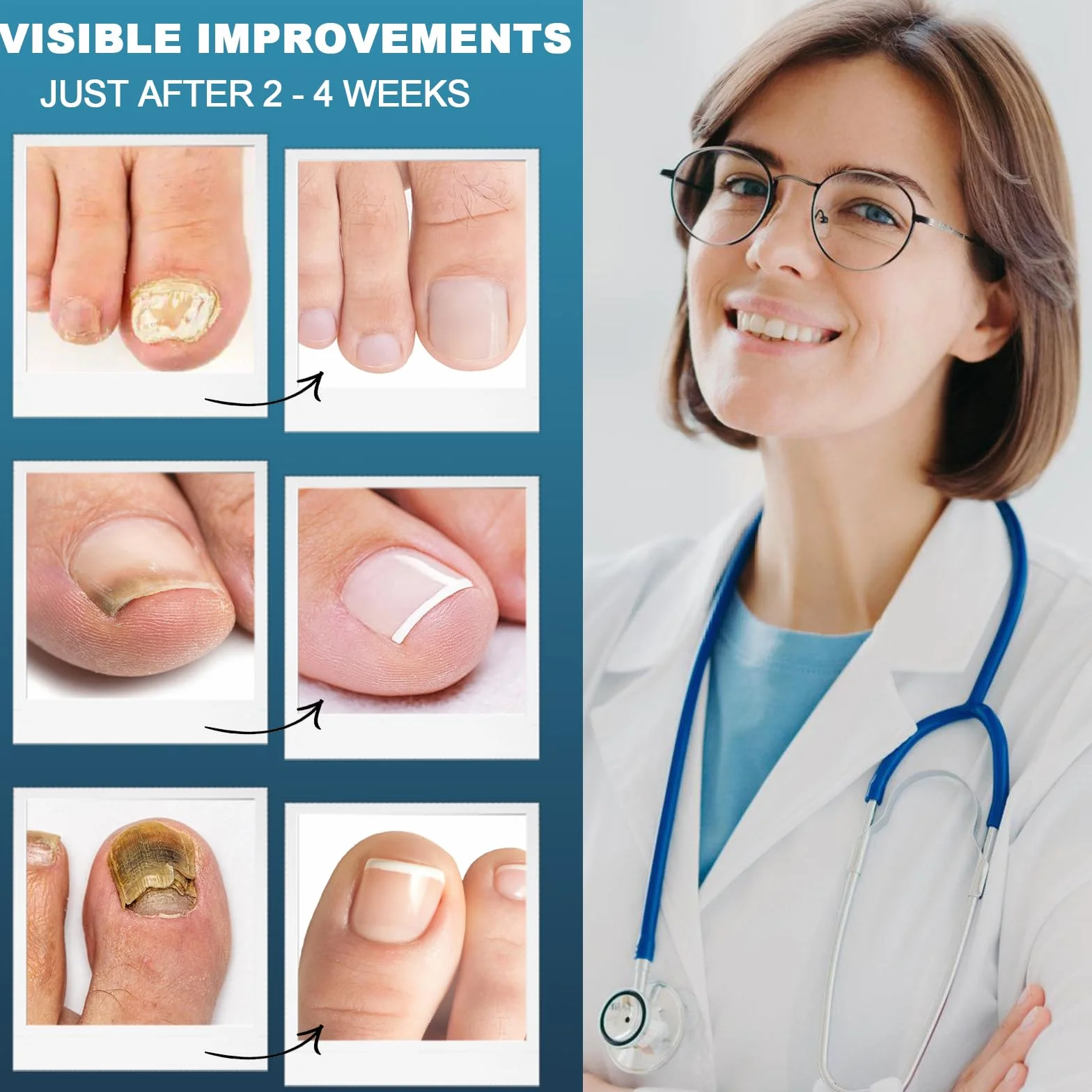 30ML Cura Unghie Piedi, Siero Rigenerante per Unghie, Soluzione per La Riparazione Delle Unghie Dei Piedi, Azione Nutriente e Lenitiva, Ridona Lucentezza e Resistenza