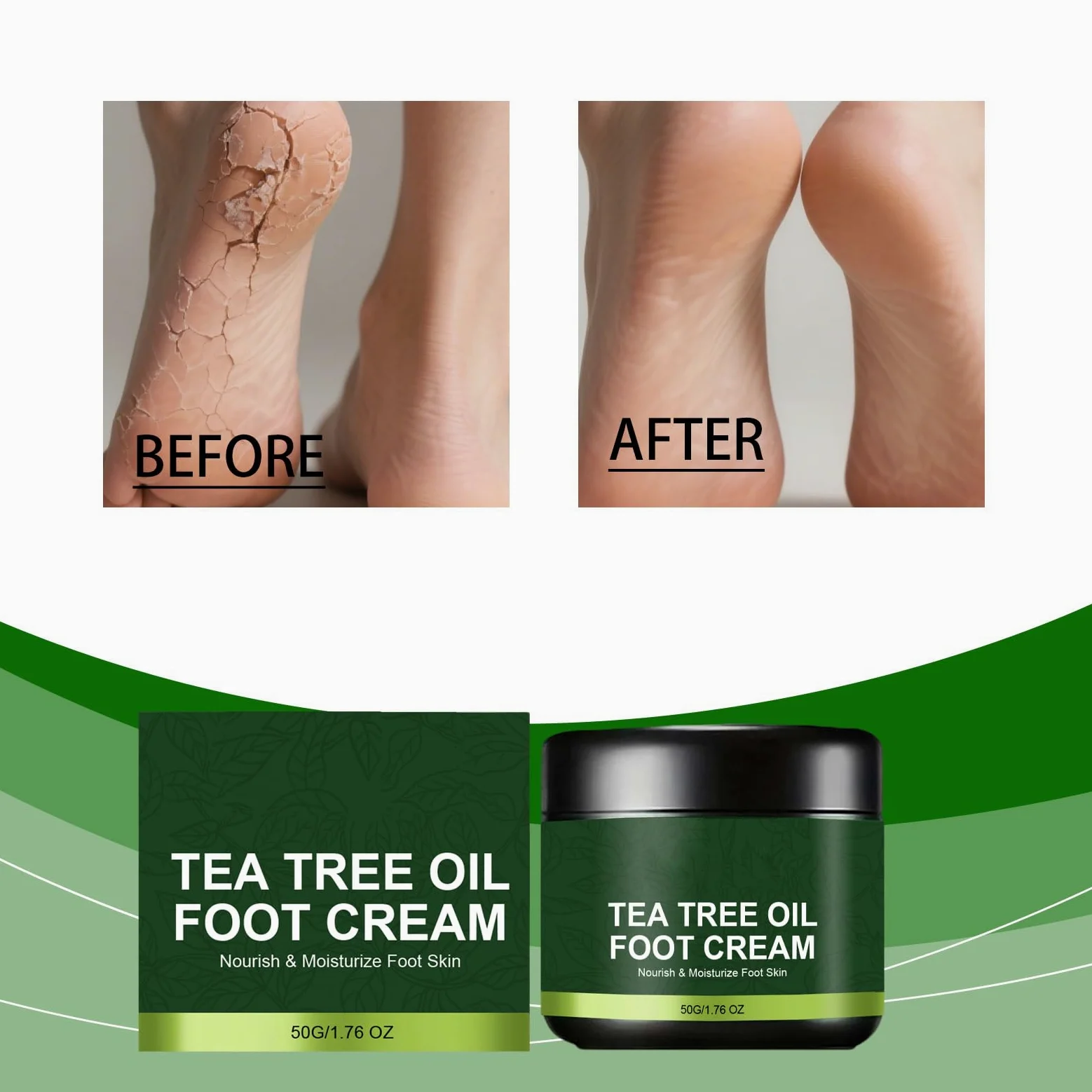 Crema per piedi con olio di albero del tè e vitamina E, per talloni e piedi secchi e screpolati, balsamo idratante intensivo per riparare, curare e rigenerare piedi ruvidi e secchi (6 pezzi)