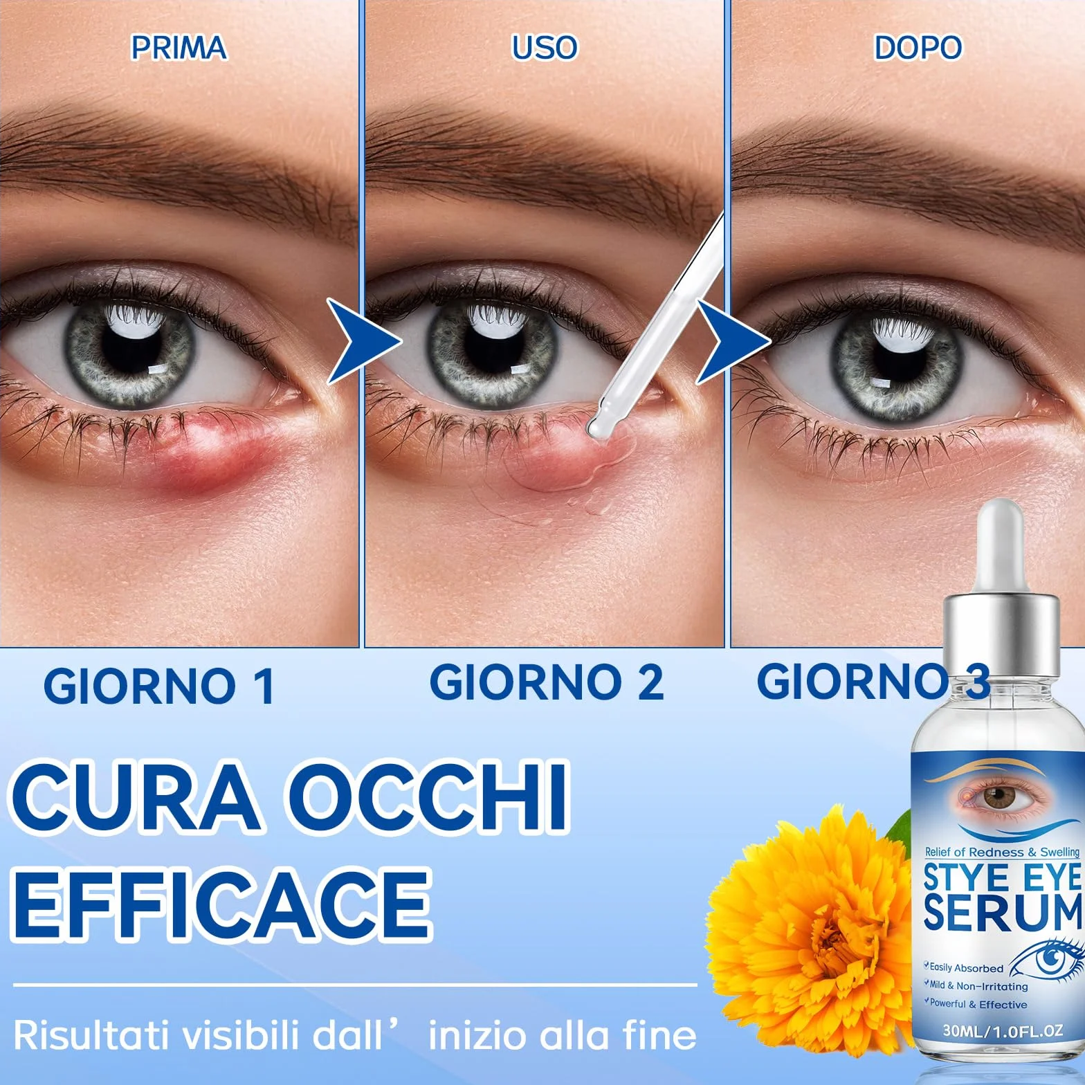 Siero Oculare per Orzaioli, Siero Naturale per Occhi, Adatto a Orzaioli, Blefarite, Calazi e Secchezza Oculare, Pulizia quotidiana occhi, Allevia la Secchezza, Dona Una Pelle Più Sana