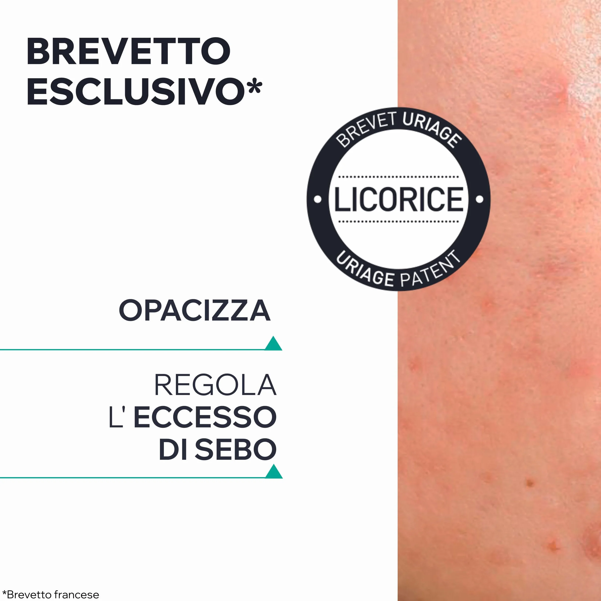 Uriage Hyseac Pasta SOS con Árbol del Té, Zinc y Arcilla Verde - Acelera la Maduración de las Imperfecciones de la Noche a la Mañana y Limita las Marcas en la Piel - Para Granos e imperfecciones.