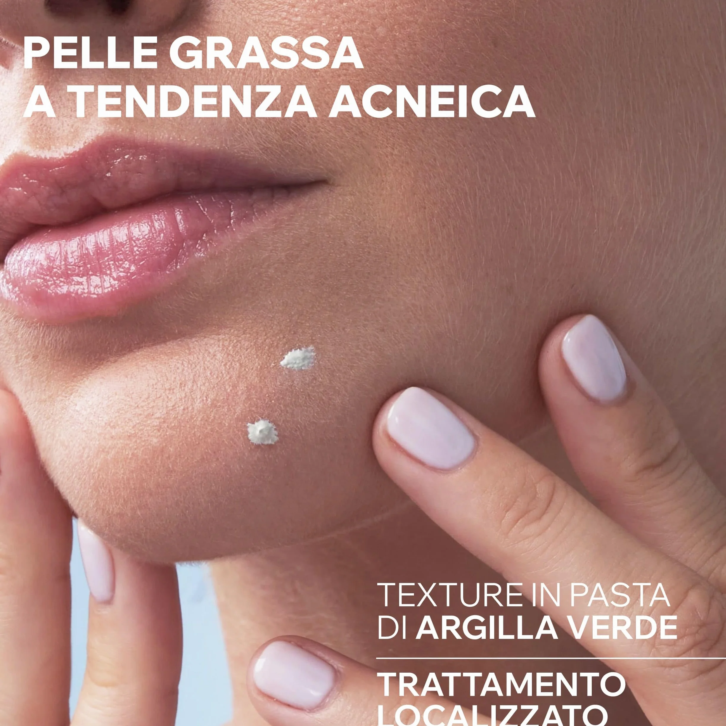 Uriage Hyseac Pasta SOS con Árbol del Té, Zinc y Arcilla Verde - Acelera la Maduración de las Imperfecciones de la Noche a la Mañana y Limita las Marcas en la Piel - Para Granos e imperfecciones.