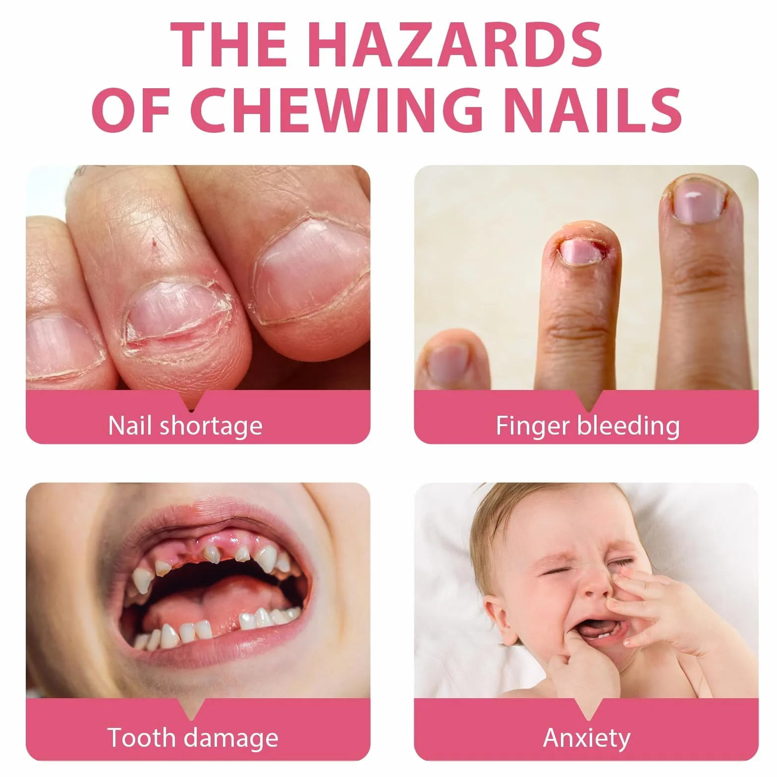 10 ML Smalto Trasparente, Liquido Per Smettere Di Mangiarsi Le Unghie, Trasparente E Facile Da Applicare, Stop A Prevenire La Masticazione Delle Unghie