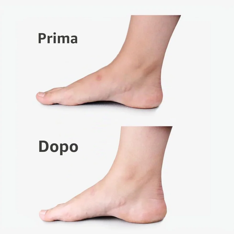 ScarGone Massaggiatore per minimizzare le cicatrici, trattamento efficace per viso e corpo, mira a cheloidi, acne, ustioni, scure e cicatrici chirurgiche, riduce la comparsa di ferite nuove e vecchie