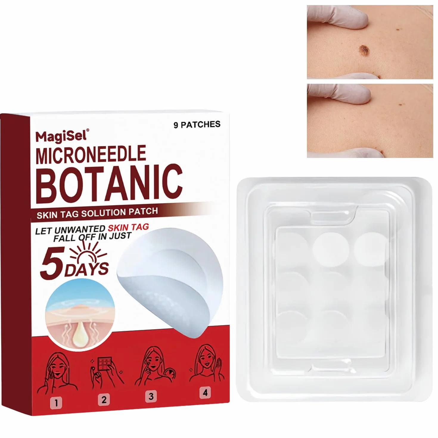 Skin Tag Removal Patches, Skin Tag Remover, Rimozione di Talpe, Acne Patch, Rimozione di Verruche, Patch per la Riparazione e Trattamento Della Pelle, Per uomini e donne 81Pezzi