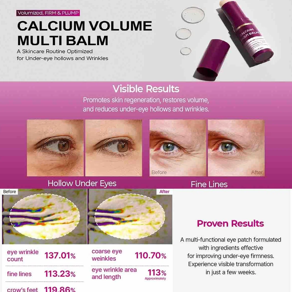 Calcium Multi Balm,Balsamo Multiuso Al Calcio,Balsamo Multi Rughe,Stick Volumizzante Antirughe,Stick Idratante Al Collagene,Idratante e Rassodante,Adatto a Occhi,Collo,Viso (1 pz, 9g)
