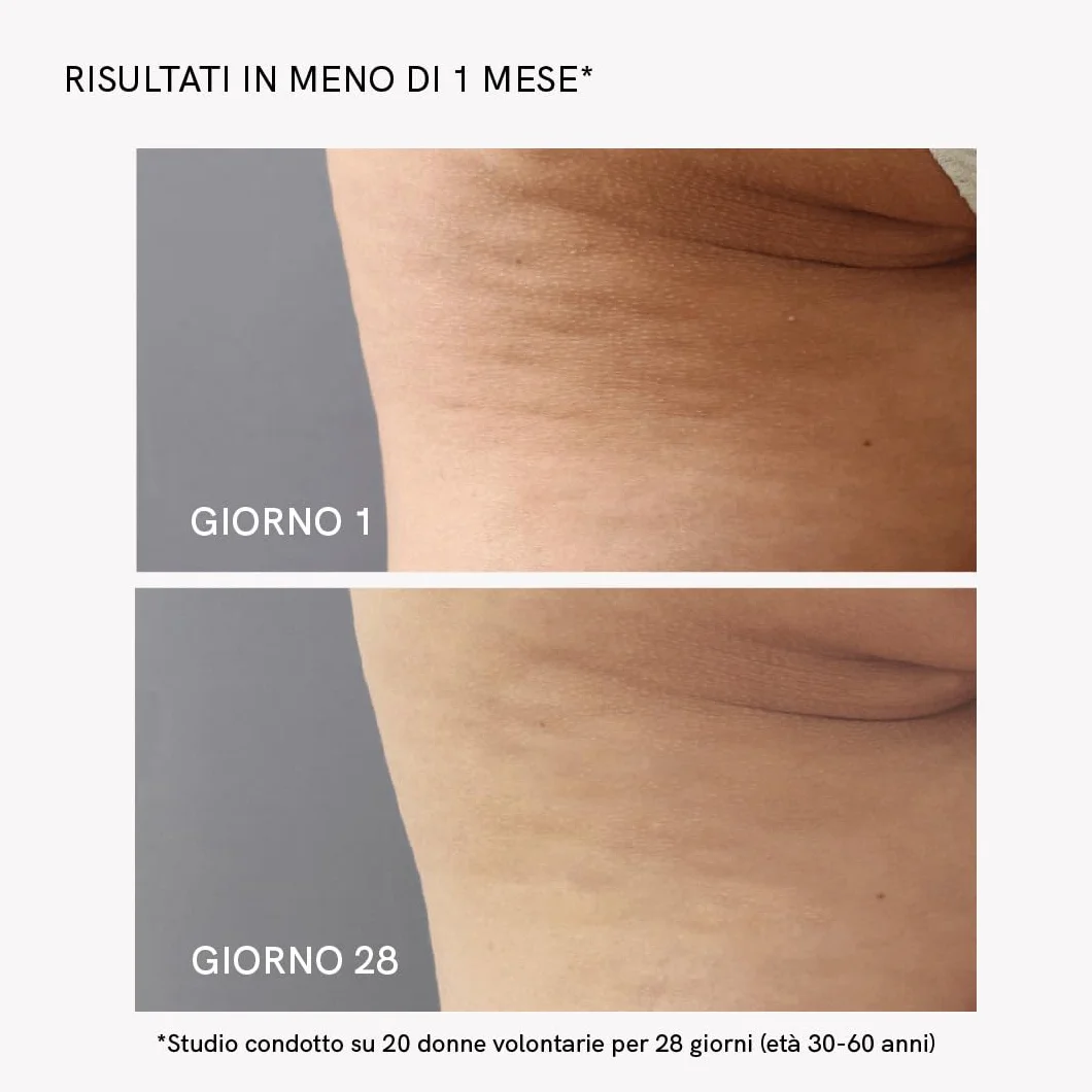 MASDERM - Crema Anticellulite Riducente 500 ml, Crema Rassodante Corpo, Gel Riducente Addome e Glutei per Radiofrequenza Corporea, Trattamento Anticellulite Professionale, Pelle Soda e Tonica
