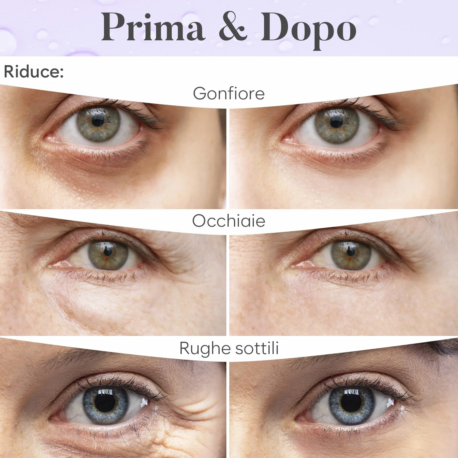Patch Occhi Giorno e Notte, Maschera Occhi con Caffeina, Collagene e Acido Ialuronico, Patch Occhiaie e Borse, Maschera Occhiaie, Eye Mask per l'idratazione e Gonfiore (30 Paia)