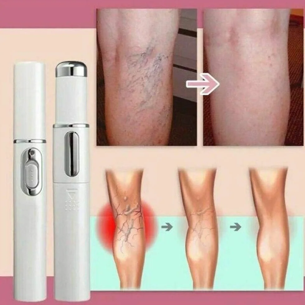Penna Laser per Terapia a Luce Blu per vene varicose, Antirughe e Acne