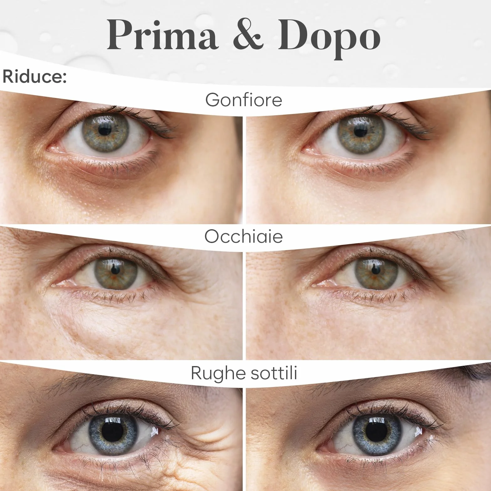 BLOOMORA Patch Occhi (30 paia, Mix Varietà), Maschera Occhi per Un'idratazione Profonda, Patch Occhiaie e Borse, Eye Mask per l'idratazione