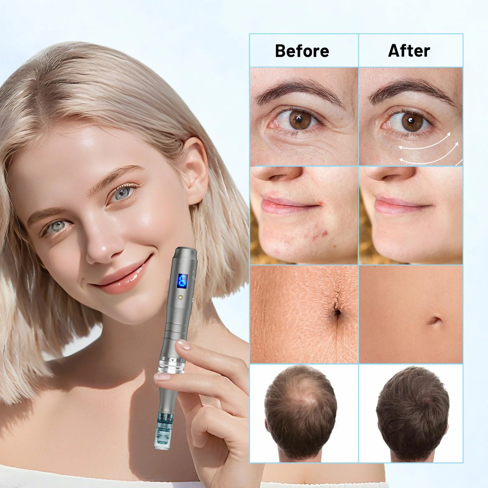 Dr. Pen M8S Microneedling Pen Professionale Wireless, Dermapen Elettrico Senza Fili con 25 Cartucce Aghi Originali, 6 Velocità Regolabili e Display LED, Trattamento Pelle Viso, Capelli e Corpo