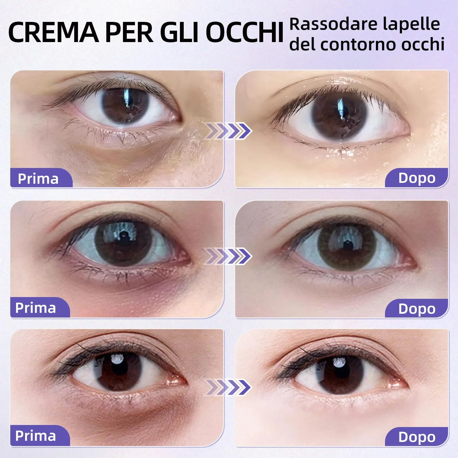 Crema Contorno Occhi alla Caffeina 20g, Riduce le Occhiaie e il Gonfiore, Contiene Niacinamide e Acido Ialuronico, Idratante, Adatta a Tutti i Tipi di Pelle