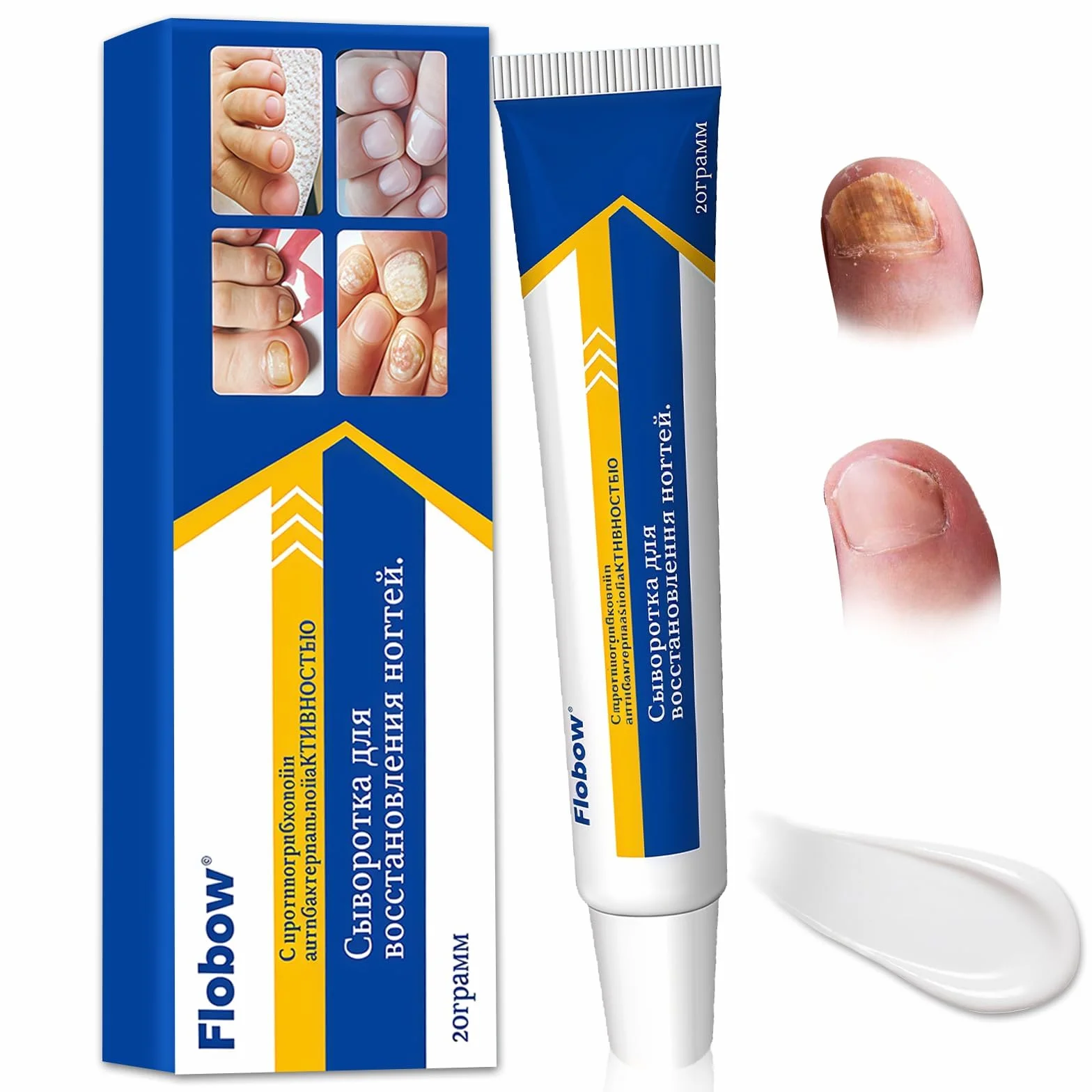 20g Crema per Riparazione Unghie,Cura delle Unghie,Proteggi e Rigenerate per Piede Nail,Ripristina le Scolorite,Nutre e Lenisce Le Unghies Donne e Uomini