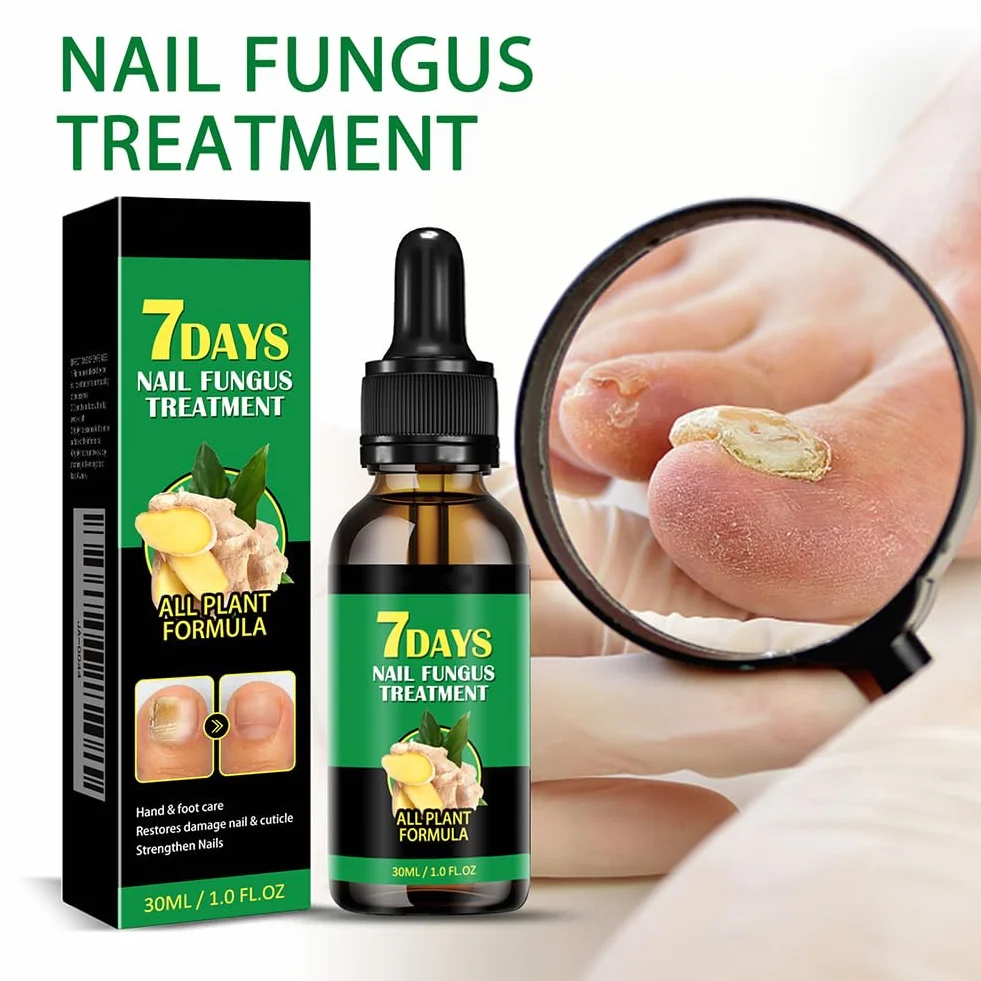 Siero per Unghie allo Zenzero da 30 ml, Siero per Unghie Rinforzante e Riparatore, Olio per Unghie allo Zenzero per Rafforzare le Unghie