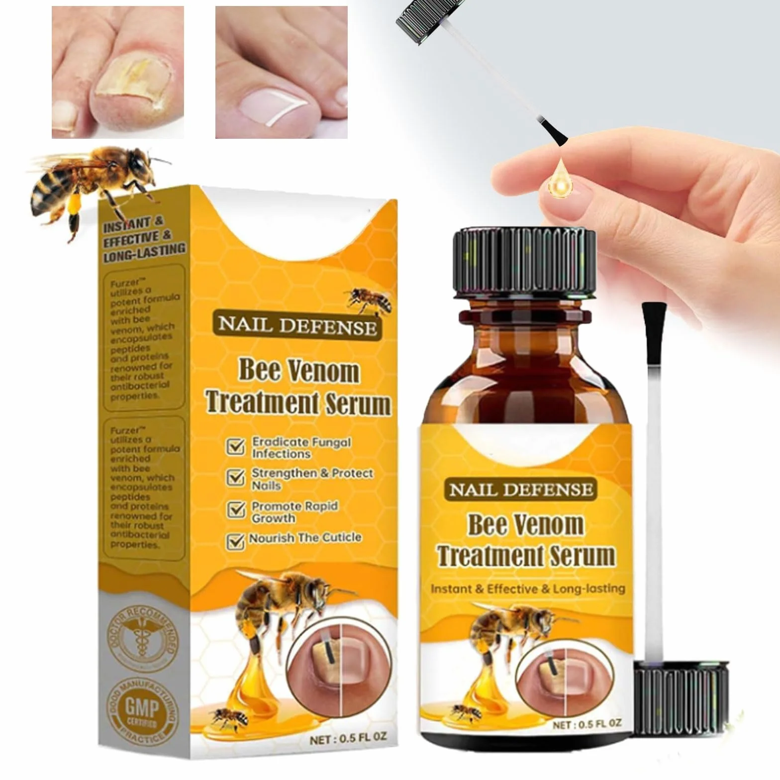Trattamento per unghie incarnite al veleno d'api, siero per il trattamento delle unghie, siero per la crescita e la riparazione delle unghie, trattamento per unghie incarnite, trattamento con olio per