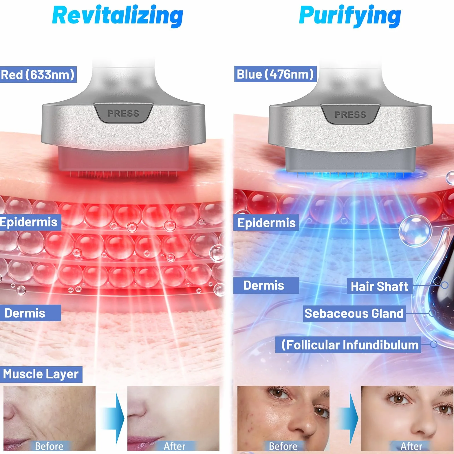 Microneedling Stamp Bio 6 – Derma Stamp Professionale 4 in 1 con Microneedling, EMS, Terapia Luce Rossa/Blu, Massaggio Vibrante– Ringiovanimento Viso, Anti-Età, Crescita Capelli