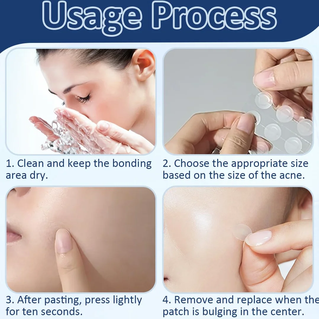 EIHI 288 cerotti per verruche, acne, formula delicata, trattamento efficace, naturale, cerotti per verruche viso e corpo, indolore, trattamento efficace
